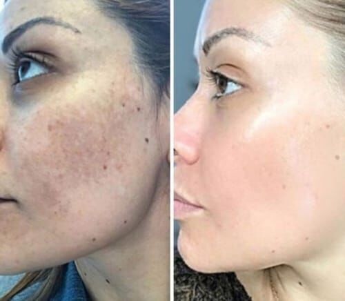 Wiki Whitening Cream / Acne Serum / Glow Combo – Pakistan ka Best Skin Care Solution