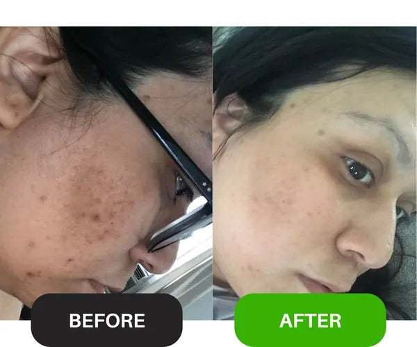 Wiki Whitening Cream / Acne Serum / Glow Combo – Pakistan ka Best Skin Care Solution