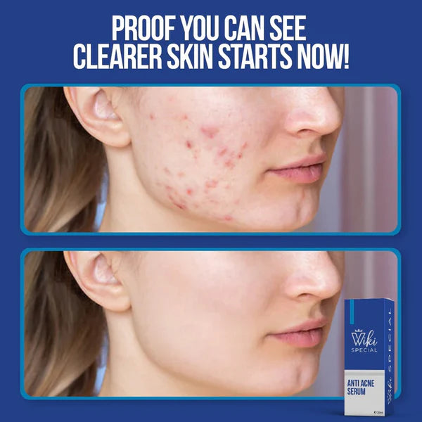 Wiki Whitening Cream / Acne Serum / Glow Combo – Pakistan ka Best Skin Care Solution